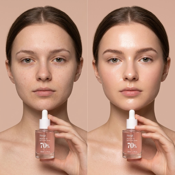 Niacinamide 10% + Perzik Serum